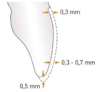 Diagrama de um dente limado