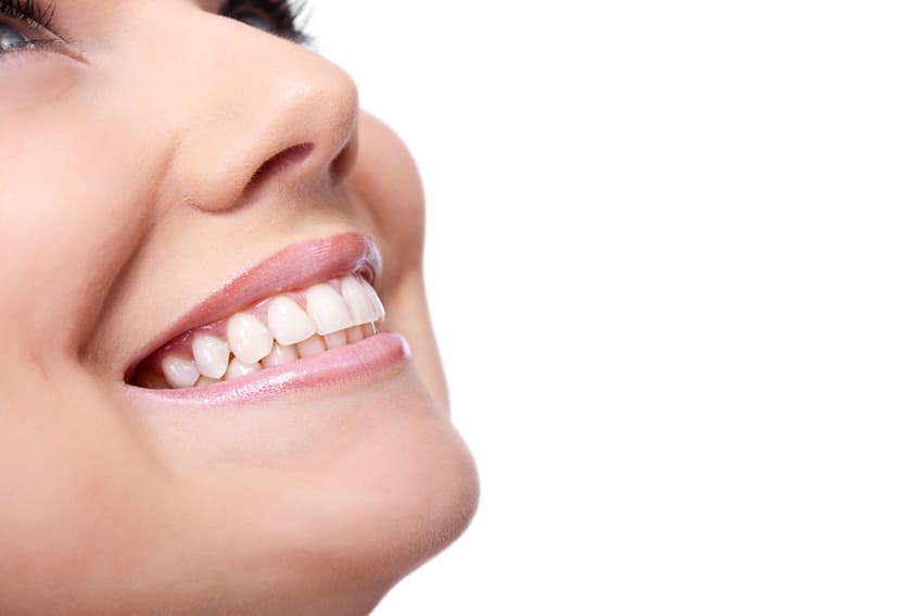 Depois de facetas dentárias na Turquia