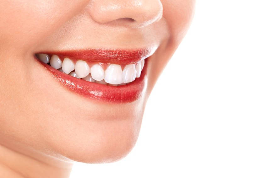 lumineers facetas dentárias na Turquia