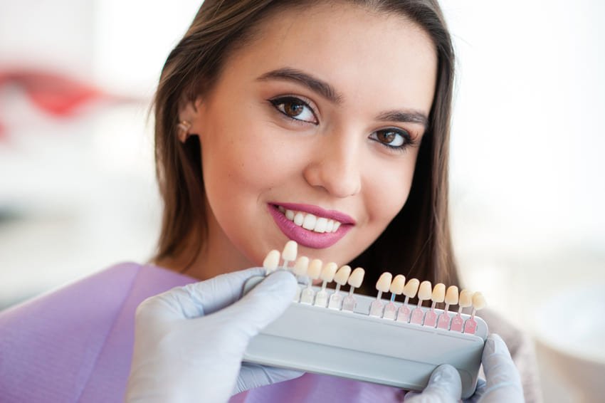 Escolher a cor certa para facetas dentárias